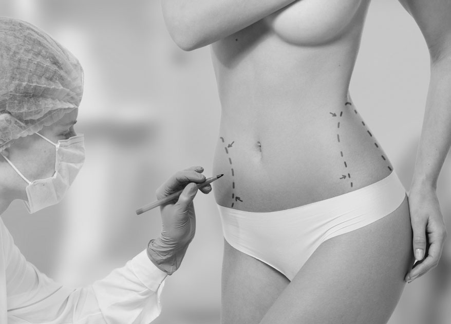 chirurgie esthetique abdominoplastie lausanne