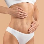 chirurgie esthetique liposuccion lausanne