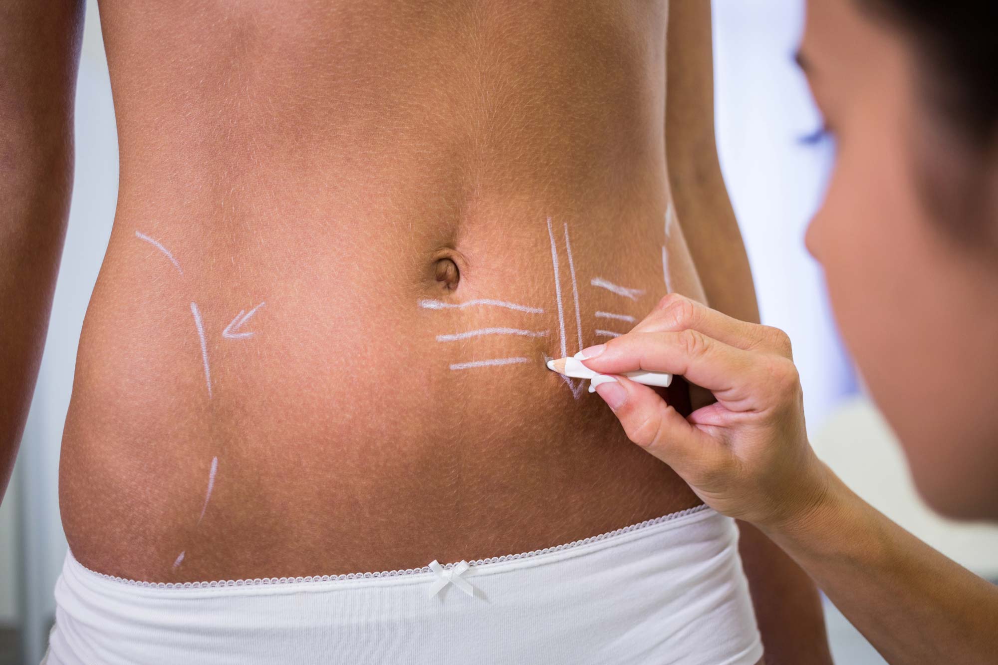 chirurgie esthetique peau ventre lausanne