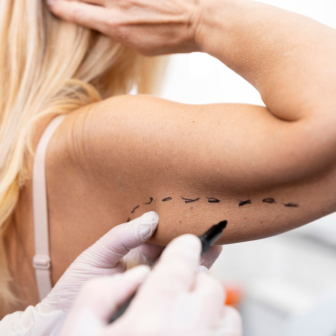 chirurgie esthetique a lausanne