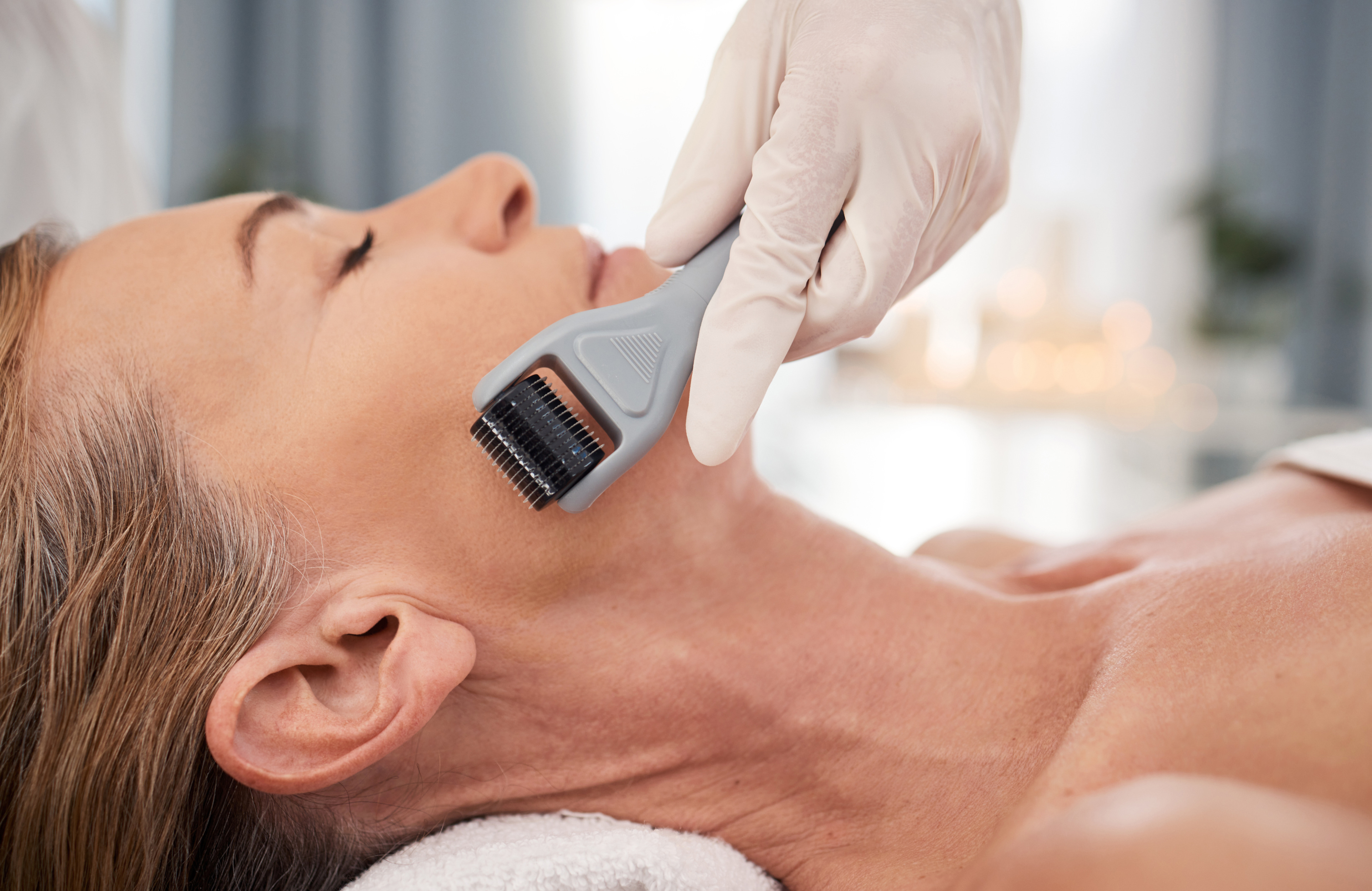 chirurgien microneedling lausanne dr mercadier